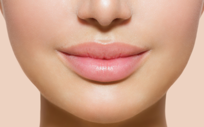 Natural Lip Enhancement